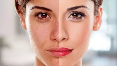 بهترین لیزر روشن کننده پوست در رشت چیست؟